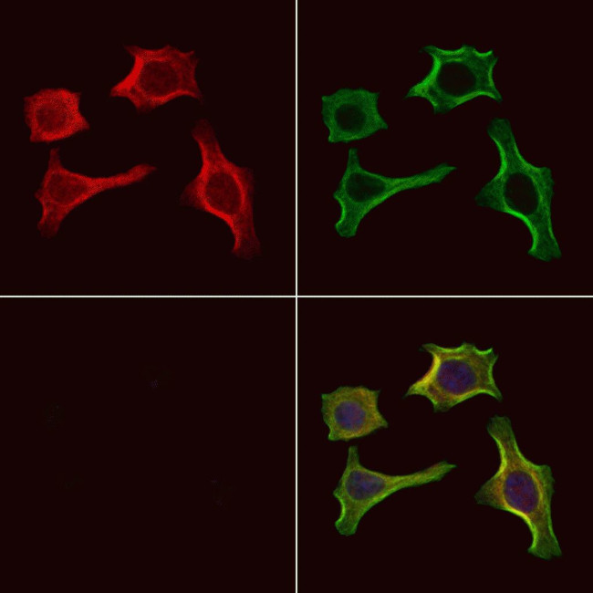 Phospho-CaMKII alpha/beta/delta (Ser235) Antibody in Immunocytochemistry (ICC/IF)