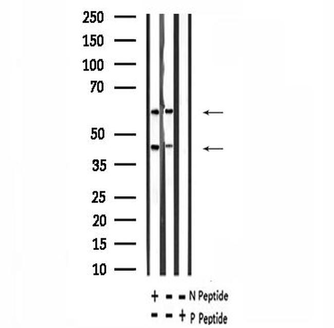 Phospho-CaMKII alpha/beta/delta (Ser235) Antibody in Western Blot (WB)