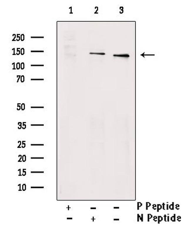 Phospho-PRK1/PRK2 (Ser815) Antibody in Western Blot (WB)