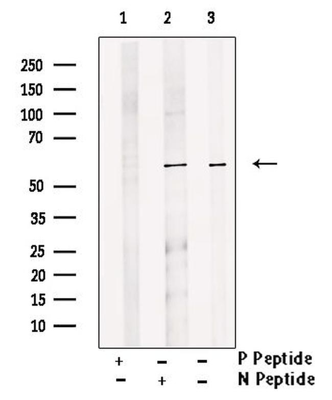 Phospho-PRAK (Ser354) Antibody in Western Blot (WB)