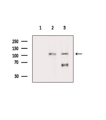 Phospho-NEDD4L (Ser479) Antibody in Western Blot (WB)