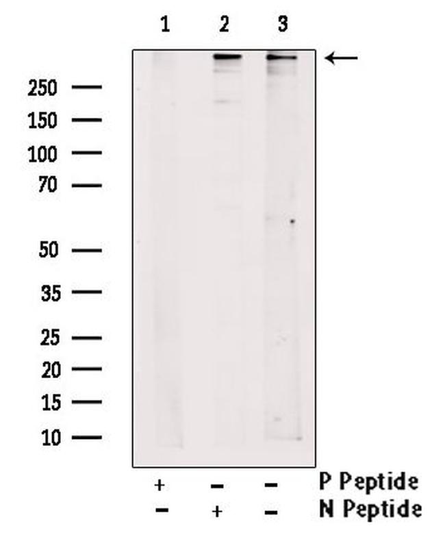 Phospho-RyR2 (Ser2808) Antibody in Western Blot (WB)