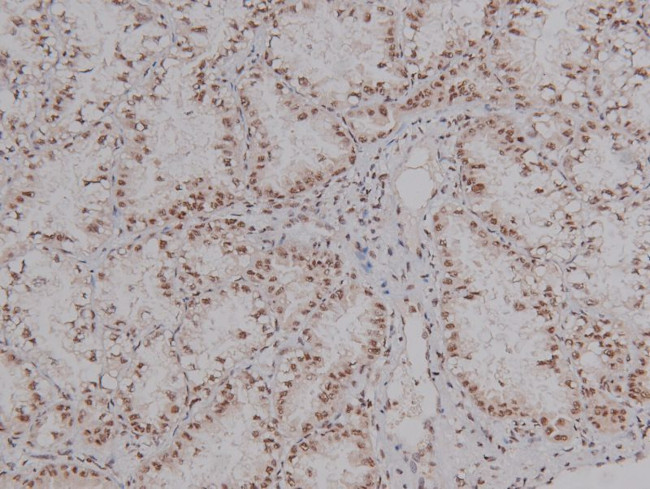 Phospho-CEACAM1 (Ser508) Antibody in Immunohistochemistry (Paraffin) (IHC (P))