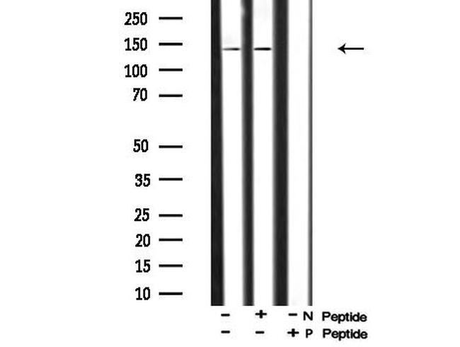 Phospho-PDGFRA (Tyr762) Antibody in Western Blot (WB)