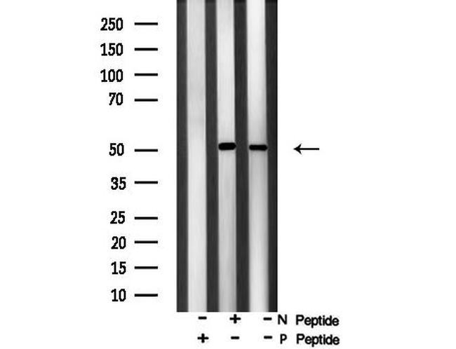 Phospho-PPAR alpha (Ser21) Antibody in Western Blot (WB)