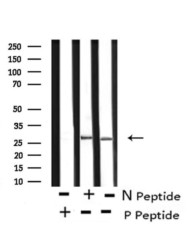 Phospho-Caveolin 2 (Ser36) Antibody in Western Blot (WB)