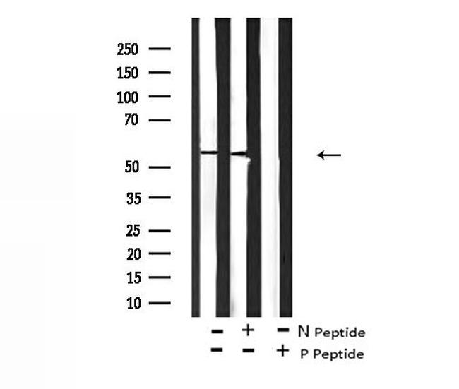 Phospho-PDPK1 (Tyr376) Antibody in Western Blot (WB)