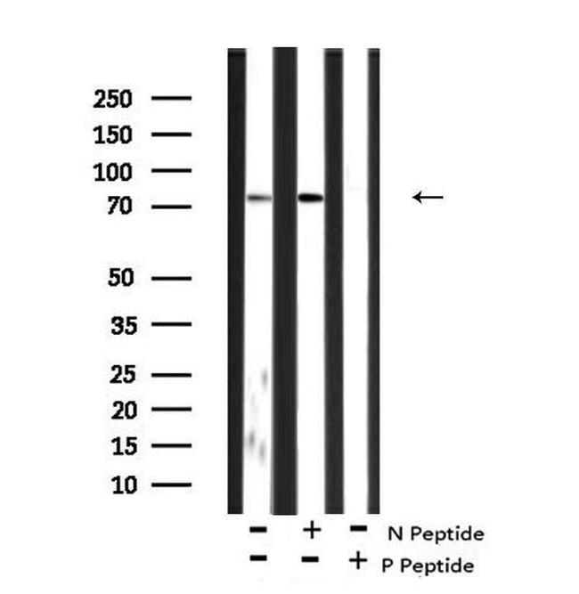 Phospho-MSK2 (Ser196) Antibody in Western Blot (WB)