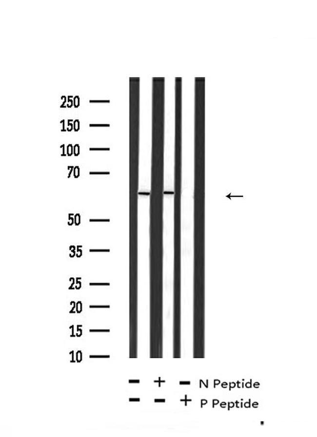 Phospho-TGFBR2 (Tyr284) Antibody in Western Blot (WB)