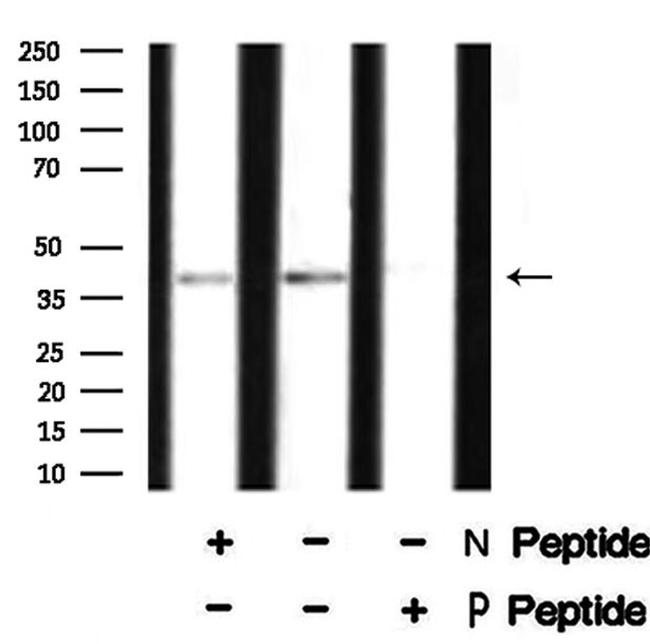 Phospho-XPA (Ser196) Antibody in Western Blot (WB)
