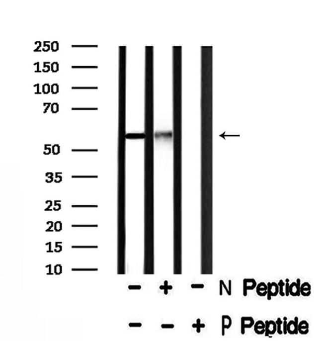 Phospho-PFKFB2 (Ser466) Antibody in Western Blot (WB)