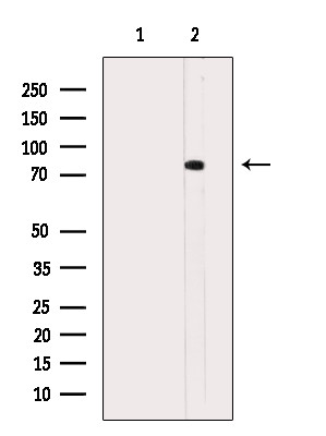 Phospho-ALOX5 (Ser664) Antibody in Western Blot (WB)