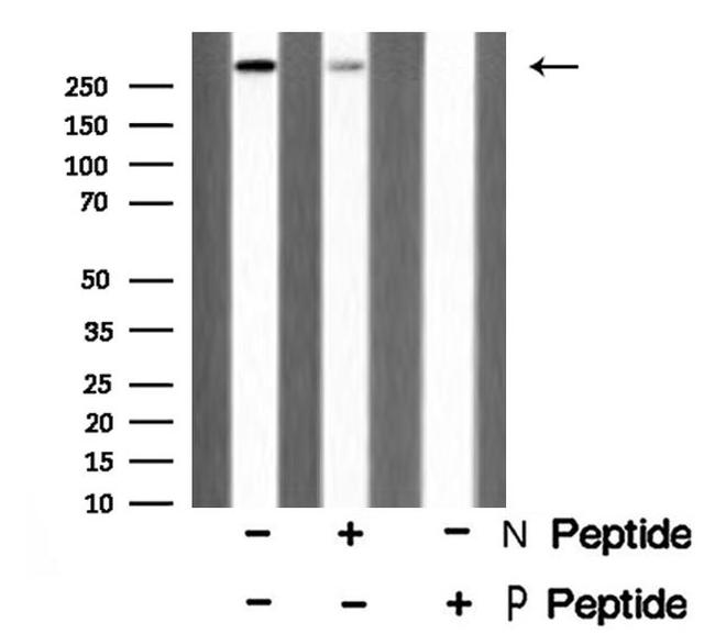 Phospho-ATM (Ser794) Antibody in Western Blot (WB)