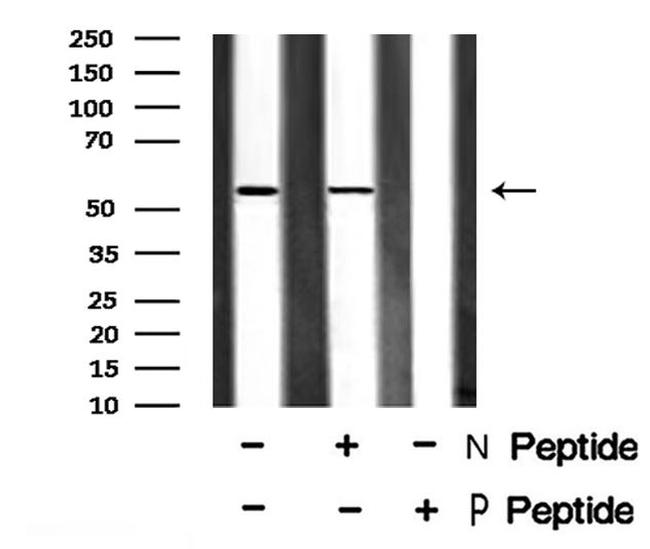Phospho-EpoR (Tyr456) Antibody in Western Blot (WB)