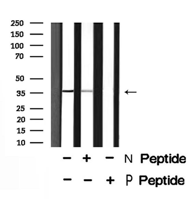 Phospho-eIF2 beta (Ser67) Antibody in Western Blot (WB)