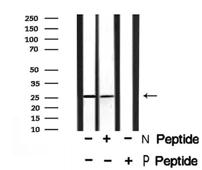 Phospho-EIF6 (Ser235) Antibody in Western Blot (WB)