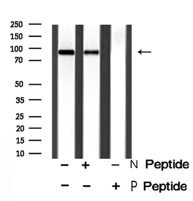 Phospho-NHE3 (Ser555) Antibody in Western Blot (WB)