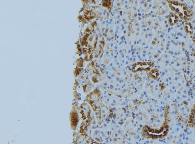 NBR1 Antibody in Immunohistochemistry (Paraffin) (IHC (P))