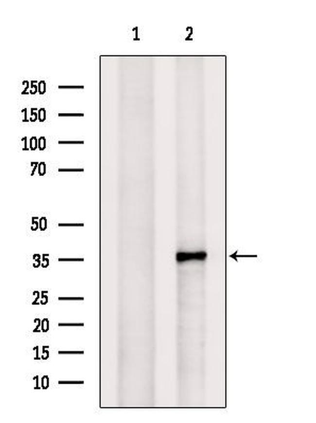 STX11 Antibody in Western Blot (WB)