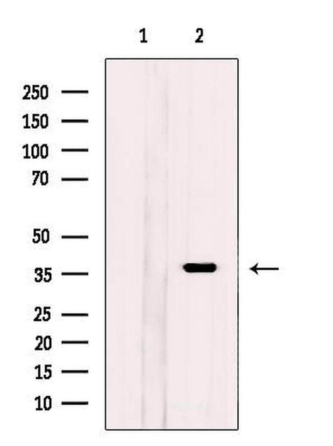 KCTD12 Antibody in Western Blot (WB)