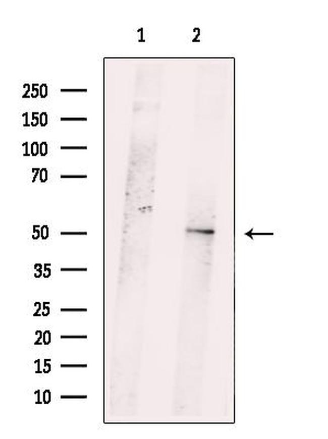 PPP1R7 Antibody in Western Blot (WB)