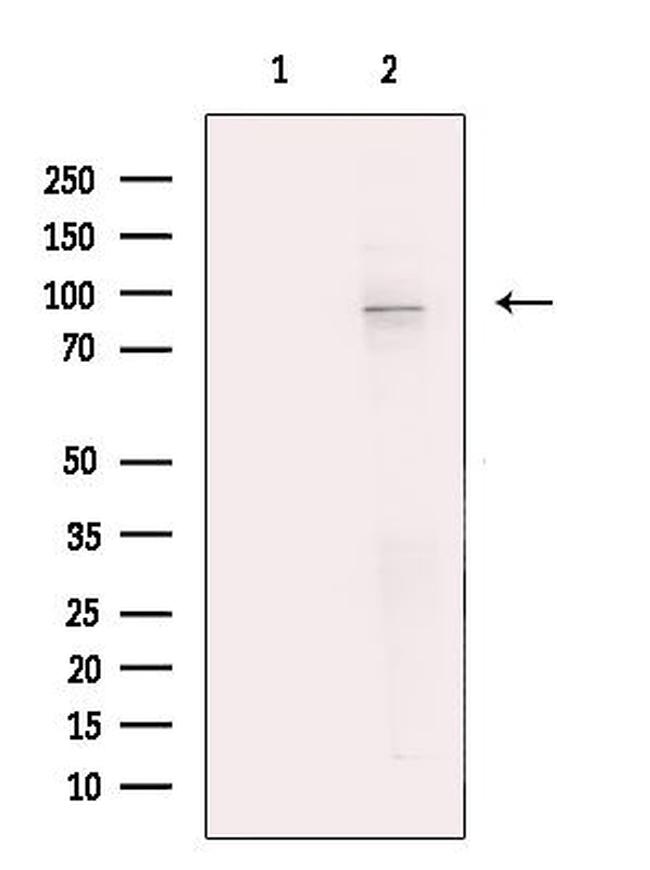 TNNI3K Antibody in Western Blot (WB)