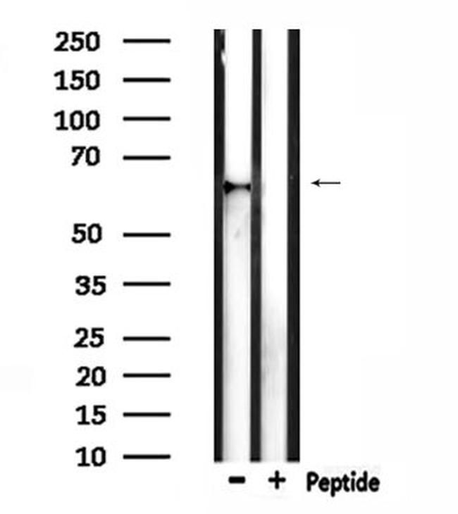 TCF7L1 Antibody in Western Blot (WB)