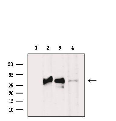 CD16 Antibody in Western Blot (WB)