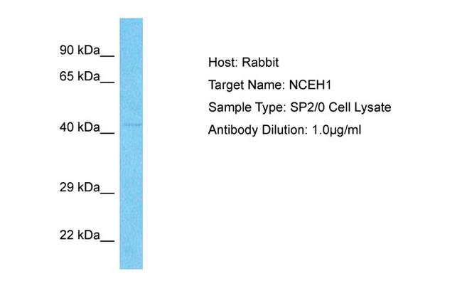 NCEH1 Antibody in Western Blot (WB)