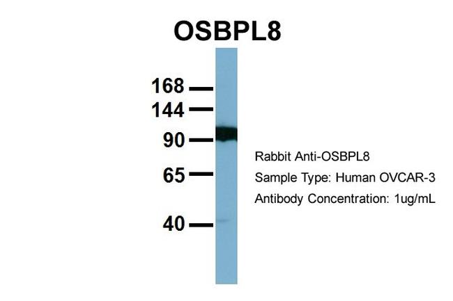 ORP8 Antibody in Western Blot (WB)