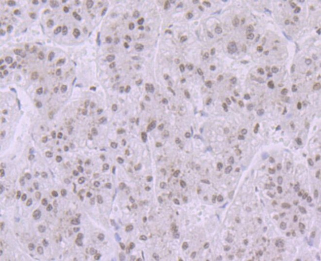 Histone H3.1 Antibody in Immunohistochemistry (Paraffin) (IHC (P))