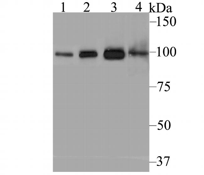 USP13 Antibody in Western Blot (WB)