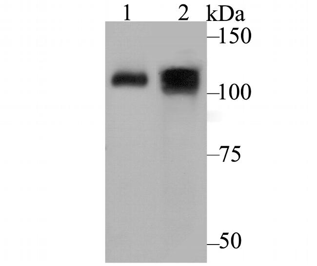 ATP2A1 Antibody in Western Blot (WB)