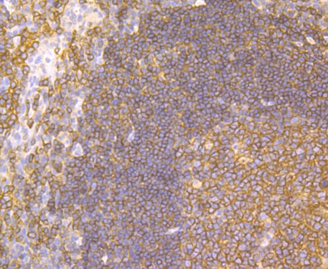 CD40 Antibody in Immunohistochemistry (Paraffin) (IHC (P))
