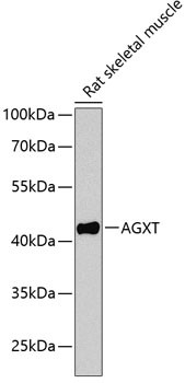 AGXT Antibody in Western Blot (WB)