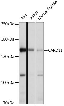 CARD11 Antibody in Western Blot (WB)