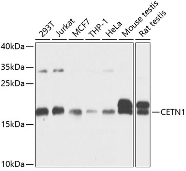 CETN1 Antibody in Western Blot (WB)