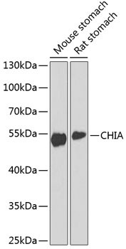 CHIA Antibody in Western Blot (WB)