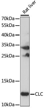 NNT1 Antibody in Western Blot (WB)