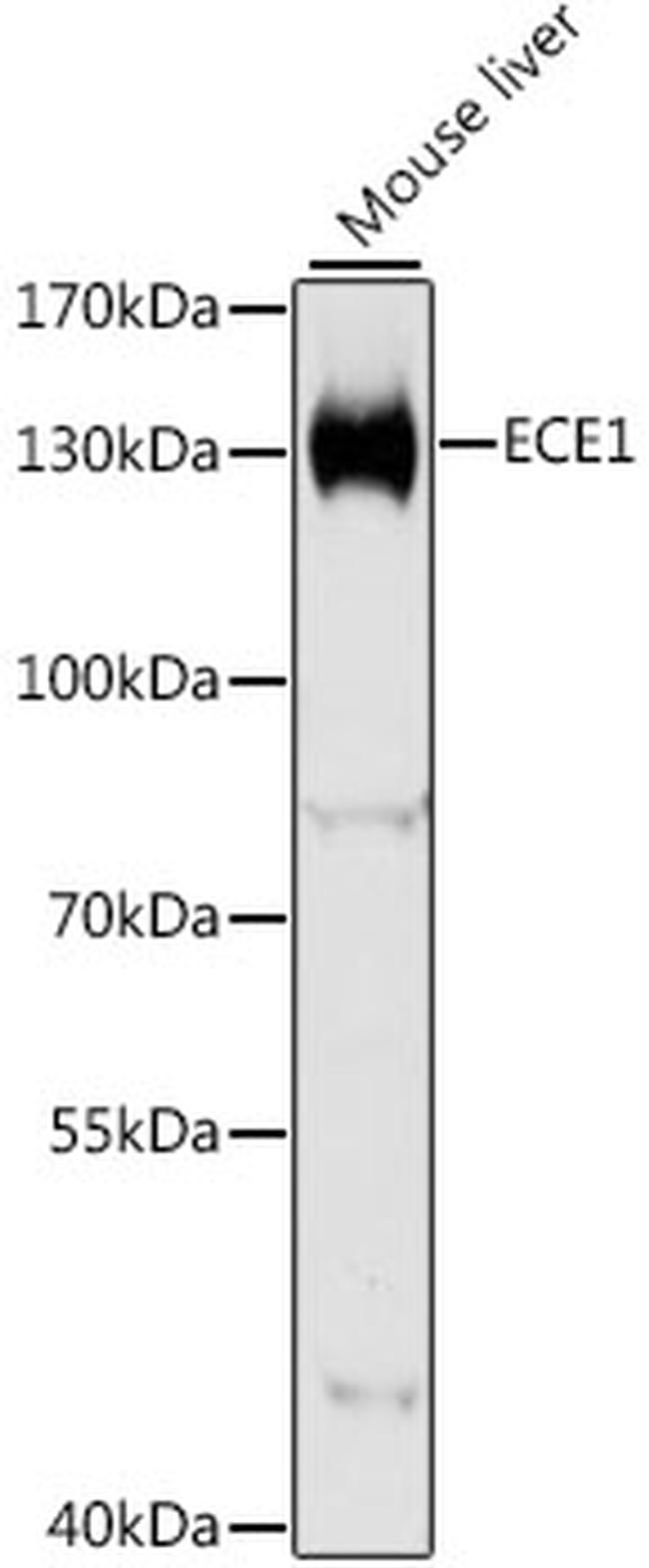 ECE1 Antibody in Western Blot (WB)