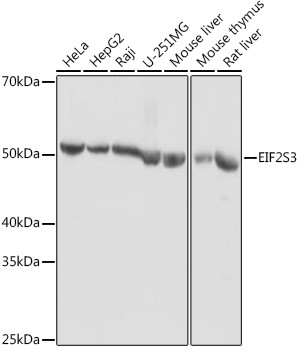 eIF2 gamma Antibody in Western Blot (WB)