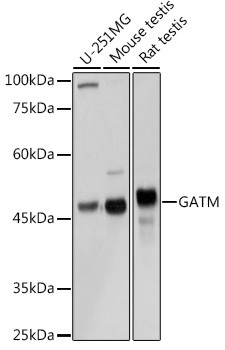 GATM Antibody in Western Blot (WB)