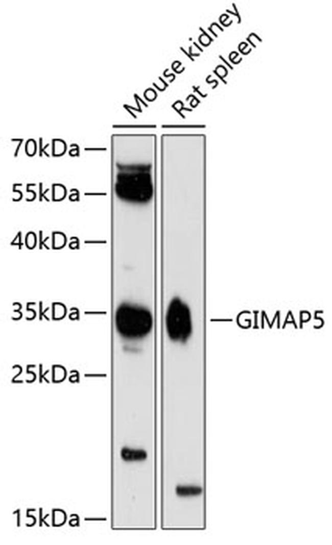 GIMAP5 Antibody in Western Blot (WB)