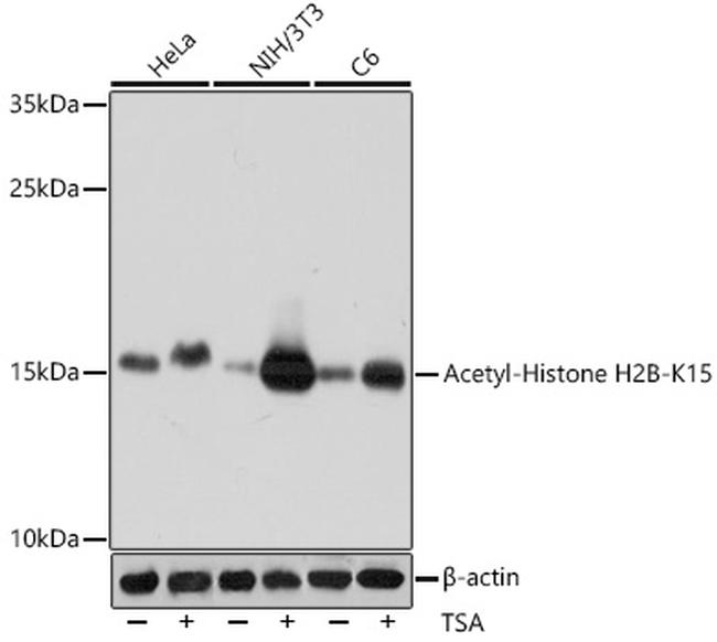 H2BK15ac Antibody in Western Blot (WB)