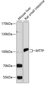 MTTP Antibody in Western Blot (WB)