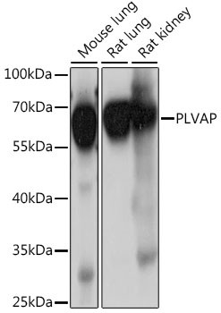 PLVAP Antibody in Western Blot (WB)