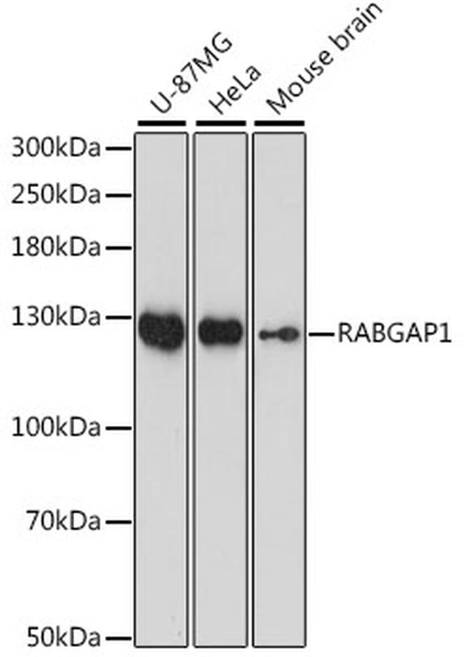 RABGAP1 Antibody in Western Blot (WB)