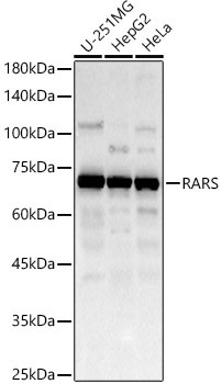 RARS Antibody in Western Blot (WB)