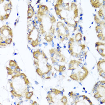 ST6GAL1 Antibody in Immunohistochemistry (Paraffin) (IHC (P))