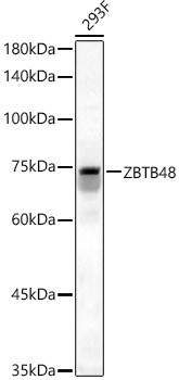 ZBTB48 Antibody in Western Blot (WB)